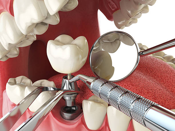 Best Emergency Denture Repair in Long Beach, MS